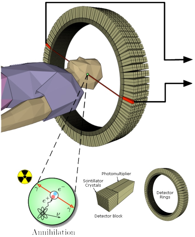 PET scan detector blocks and ring. PET scan detector blocks and ring.