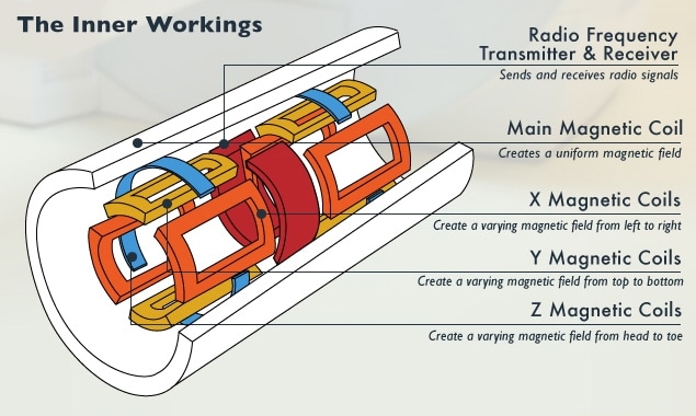 MRI transmitter, receiver, and coils. MRI transmitter, receiver, and coils.